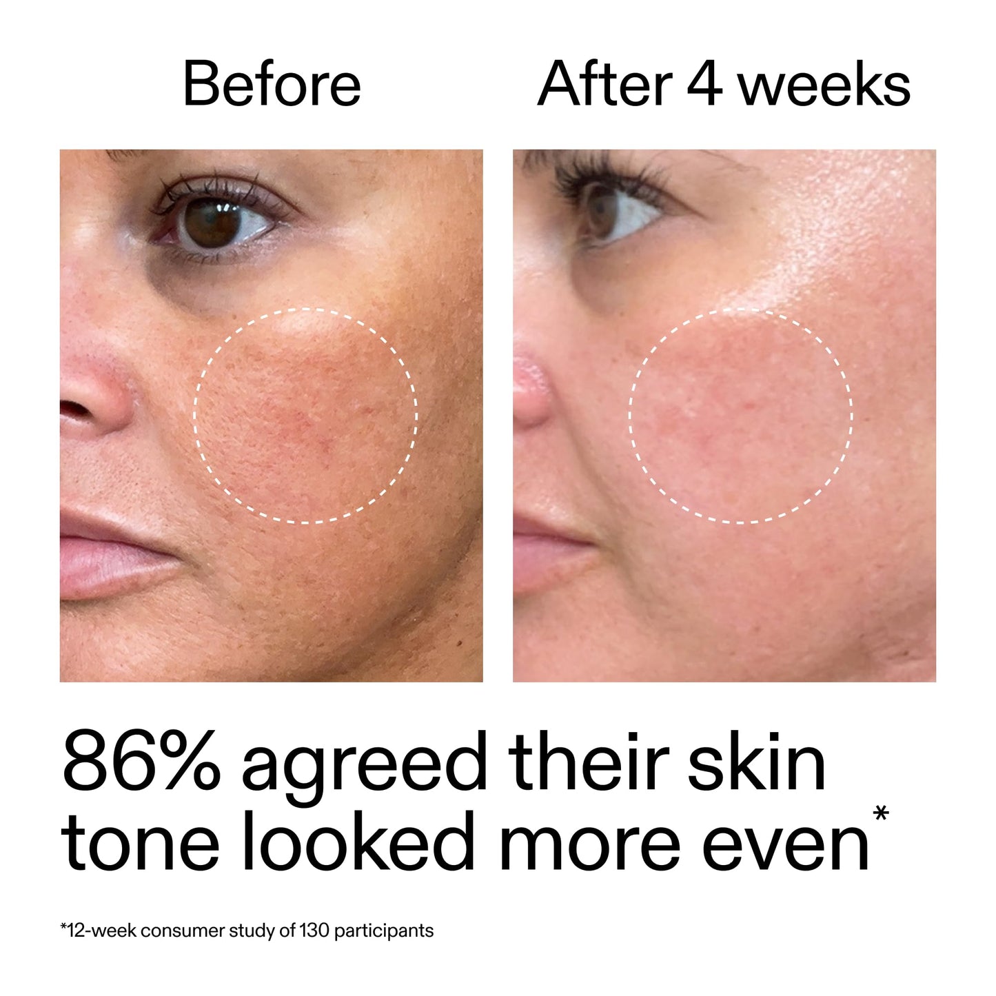 The INKEY List Starter Dual Retinol Serum 30ml, 0.5% Amisol Trio & 0.2% Symrelief, Gentle Skin Renewal, Smooths Fine Lines, Hydration & Barrier Protection, Suitable for Sensitive Skin