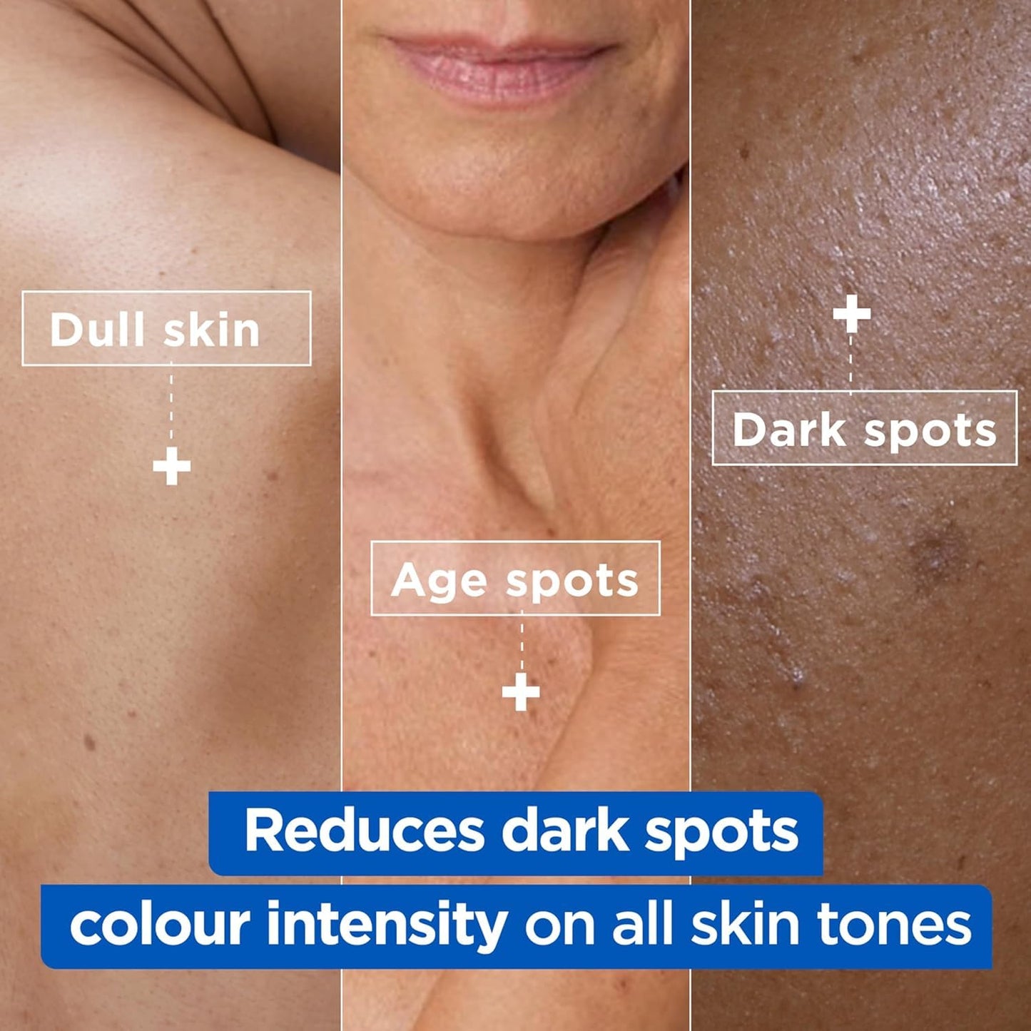 Mixa Body Cream Niacinamide Bright Moisturizing Anti-Dark Spot 400ml