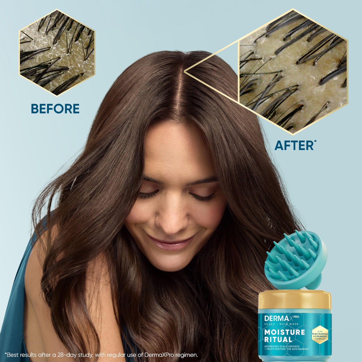 Head & Shoulders DermaXPro Dry Scalp & Hair Mask 300ml with Scalp Massager