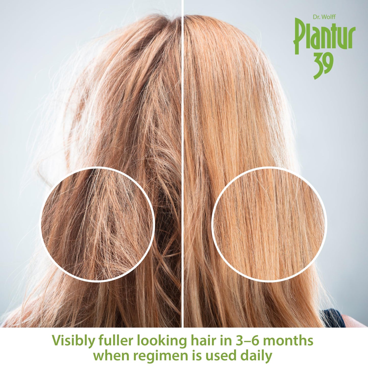Plantur 39 Caffeine Tonic Prevents and Reduces Hair Loss 200ml | Support Hair Growth and Hair Thickening | Women Hair Care Made in Germany